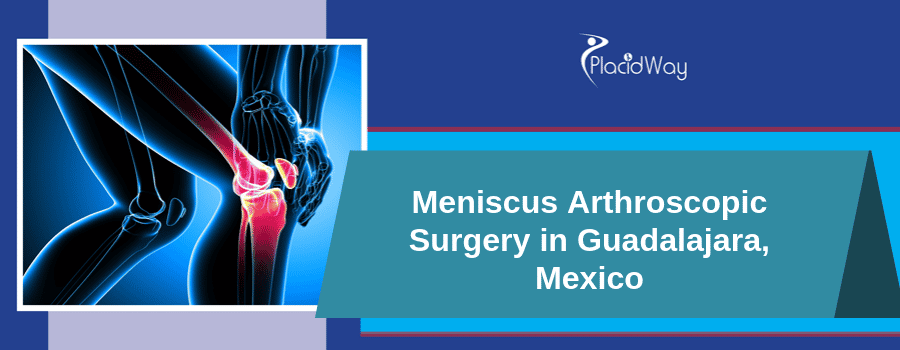 Meniscus Arthroscopic Surgery in Guadalajara, Mexico
